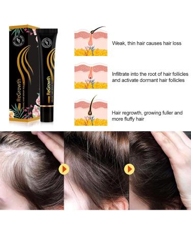 Hair Growth Serum for Men & Women | Boost Hair Growth Treat Hair Loss & Achieve Full Hair - 20ml - Buy Online on SooperMarket.com