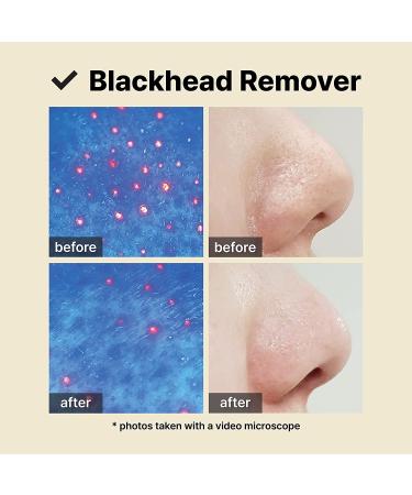 MAKEPREM Safe me Cleansing Oil 7.1 Fl Oz - PHA Formula Makeup Remover & Blackhead Removal - Buy Online on SooperMarket.com
