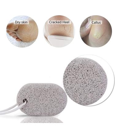 PHOGARY Natural Pumice Stone for Feet 3 PCS - Lava Pedicure Tools for Callus Removal on Feet and Hands - Exfoliating Foot File for Dead Skin Removal - Buy Online on SooperMarket.com