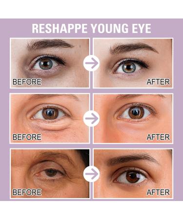 Anti-Aging Retinol Rejuvenation Eye Serum - Under Eye Cream For Dark Circles And Puffy Eyes With Collagen & Retinol Under Eye Serum Eye Serum For Lines And Wrinkles Eye Cream Anti Aging - Buy Online on SooperMarket.com