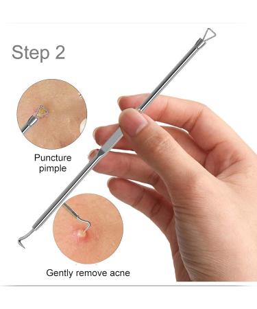 Blackhead Remover Comedone Squeezer Set Blackhead Remover Pore Cleanser Facial Cleansing Pimples Acne Whiteheads Blackhead Remover Kit with Box of 4 - Buy Online on SooperMarket.com