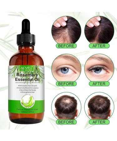 Rosemary Oil for Hair Growth Natural Rosemary Oil Nourishes the Scalp for Hair Regrowth & Hair Thickening - Hair Loss Prevention(120ml) - Buy Online on SooperMarket.com