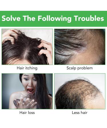 Hair Growth Serum & Rosemary Shampoo - Biotin & Castor Oil for Hair Loss | Effective Regrowth Products for Women & Men - Buy Online on SooperMarket.com