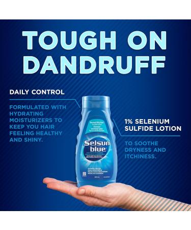 Selsun Blue Normal-Oily Hair Anti-Dandruff Shampoo 300mL Helps Control Dandruff Itching and Flaking 1% Selenium Sulfide Formula - Buy Online on SooperMarket.com