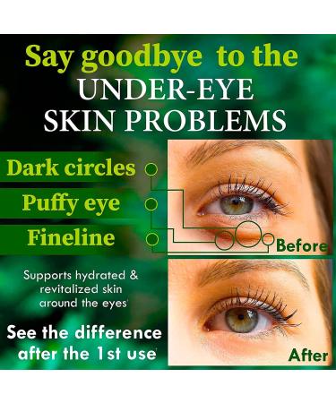 Puffy Eyes & Dark Circles Under Eye Mask with Collagen & Green Tea - Anti-Aging Treatment for Wrinkles, Puffiness & Bags - Buy Online on SooperMarket.com