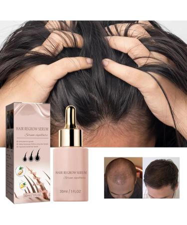 Nmbol Hair Growth Spray 1 - Buy Online on SooperMarket.com