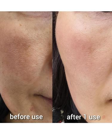 Hydrogen Dual Skin Changer Set | Hydrating Anti-Aging K-Beauty Therapy | International Shipping - Buy Online on SooperMarket.com