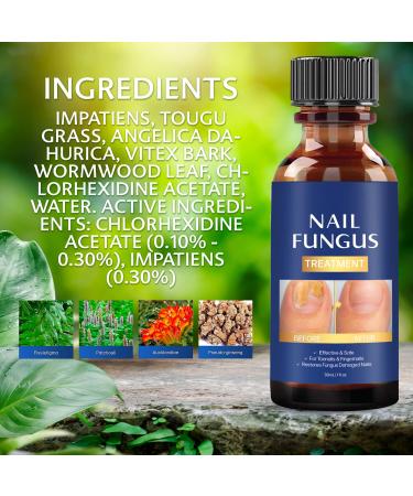 Extra Strength Toe Nail Fungus Treatment - Effective Nail Repair Solution for Healthy Nails - Buy Online on SooperMarket.com