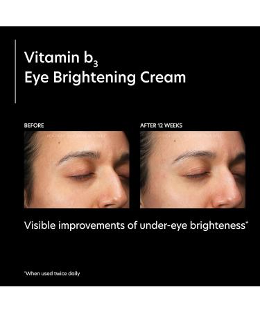 PCA SKIN Vitamin B3 Eye Brightening Cream Anti-Aging Eye Cream for Dark Circles Wrinkles & Uneven Skin Tones Niacinamide Formula 1 oz Tube - Buy Online on SooperMarket.com