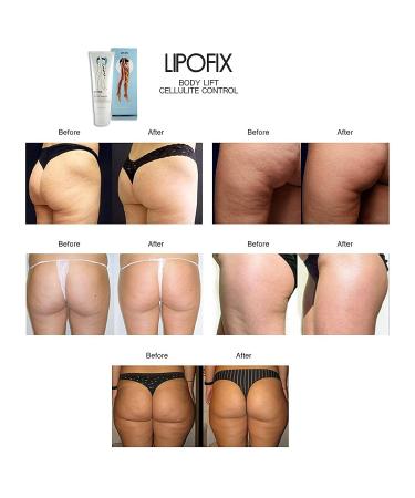 Lipofix Anti Cellulite Cream Treatment 4.06 Oz - Skin Firming & Body Shaping Formula - Buy Online on SooperMarket.com