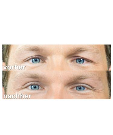 Buy Sluepflid Tape Lady Size (L) Eyelid Adhesive Strips - 240 Pieces | Small Beauty Helpers for Hanging Eyelids | Double Pack | Dermatologically Tested - Buy Online on SooperMarket.com