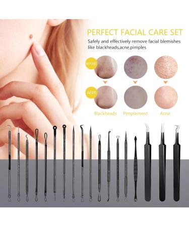 Blackhead Remover Pimple Popper Tool Kit - 19 Pcs Professional Extractor Set for Face and Nose - Stainless Steel Comedone and Whitehead Extractor with Metal Case (Black) - Buy Online on SooperMarket.com