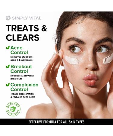 Acne Medication Face Cream - Fast Acting USA-Made Treatment for Stubborn Pimples, Blackheads, Whiteheads - Soothing Moisturizer for Acne Relief & Scar Prevention - 2oz - Buy Online on SooperMarket.com