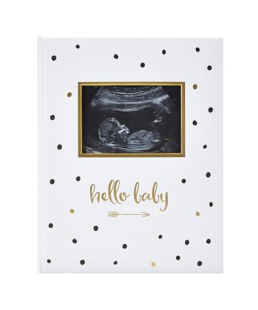 Pearhead First 5 Years Baby Memory Book, Gender-Neutral Baby Keepsake for New and Expecting Parents, Black and Gold Polka Dot, 1 Count (Pack of 1) Hello Baby Sonogram Book