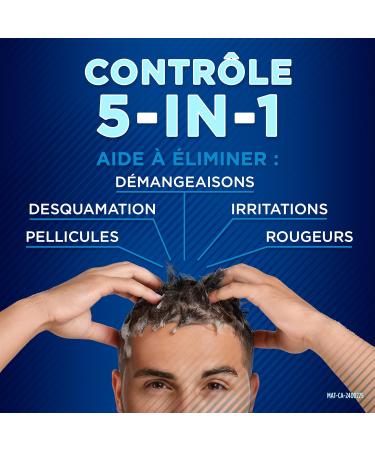 Selsun Blue Normal-Oily Hair Anti-Dandruff Shampoo 300mL Helps Control Dandruff Itching and Flaking 1% Selenium Sulfide Formula - Buy Online on SooperMarket.com