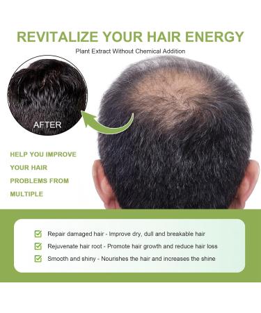 Amla Hair Oil Indian Amla Oil for Hair Amla Oil for Hair Growth Scalp Oil Nourishes Scalp Indian Hair Oil for Skin and Face Amla Essential Oil Hair Growth Oil for Women for Long Soft Strong Hair 60ml - Buy Online on SooperMarket.com