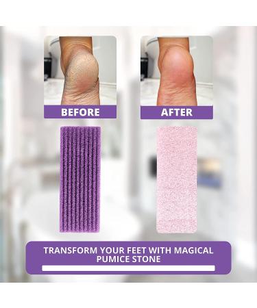 Purple Love Natural Pumice Stone - Professional Exfoliating Rock for Feet, Hands & Body - Dead Skin & Callus Removal - 2-in-1 Scrubber - Buy Online on SooperMarket.com