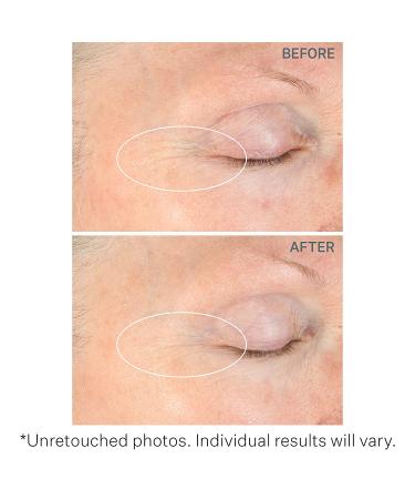 StriVectin Peptight Serum - Lift & Tighten Face & Eyes, Reduce Fine Lines - Buy Online on SooperMarket.com
