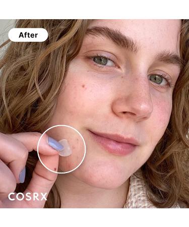 COSRX Acne Pimple Patch - 120 Count (Pack of 5) - Hydrocolloid Spot Stickers for Face and Body - Blemish and Zit Cover - Buy Online on SooperMarket.com