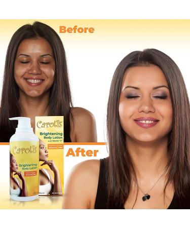 Carotis Skin Brightening Lotion 13.5 Fl oz - Carrot Oil & Vitamin A for Body, Knees, Elbows, Hands | 400ml - Buy Online on SooperMarket.com