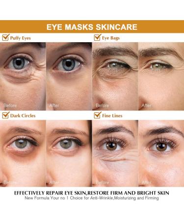 24k Gold Eye Mask - Collagen Under Eye Patches 24k Gold Eye Patches For Puffy Eyes And Dark Circles Effectively Improving Eye Bags Fine Lines And Wrinkles - 24k Gold Eye Masks Skincare(12Pair) - Buy Online on SooperMarket.com