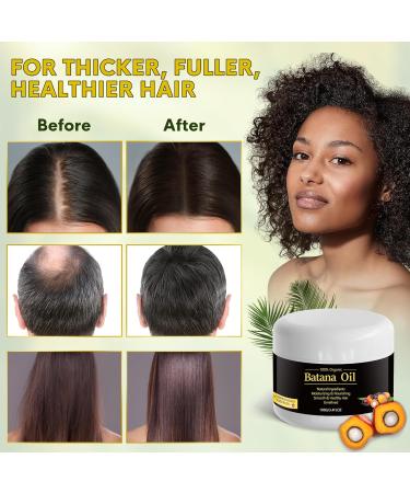 Buy Batana Hair Growth Oil - 100% Raw Organic Oil from Honduras for Men & Women | Anti Hair Loss & Split Ends Treatment - 3.4 FL oz - Buy Online on SooperMarket.com