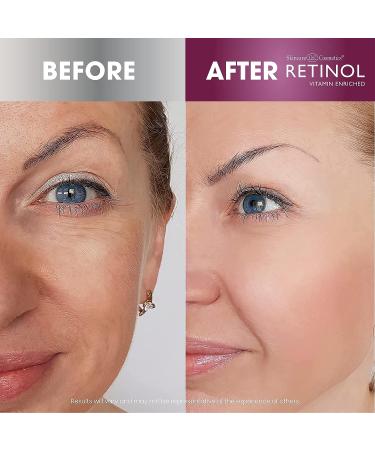 Retinol Anti-Aging Day & Night Cream Duo - 24-Hour Skincare for Younger-Looking Skin - 1oz Each - Buy Online on SooperMarket.com