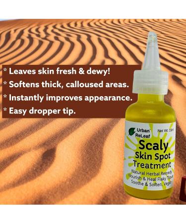 Urban ReLeaf Scaly Skin Spot Treatment - Natural Repair Oil for Flaky, Cracked, Dry Skin on Body & Face - Buy Online on SooperMarket.com