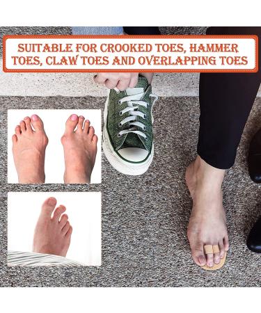 6-Piece Double Toe Straightener & Hammer Toe Splint Set - Relieve Foot Pain, Claw & Overlapping Toes - Beige - Buy Online on SooperMarket.com