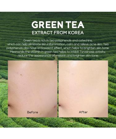 Skincare Set For Teenagers Girls Face Care Sets Skincare Gift Set 4PC Pamper Gifts For Women Includes Cleanser-Eye Cream-Serum-Face Cream Suitable For All Skin Types (One Size Green Tea) Green Tea One Size - Buy Online on SooperMarket.com