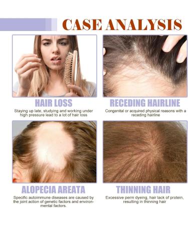 Hair Growth Oil - Hair Supplements For Women with Vitamin B6 Pumpkin Seed Oil For Skincare - Boost Hair Growth For Eyelashes Eyebrows & Dry Damaged Hair Moisturizer Face Hair - Buy Online on SooperMarket.com