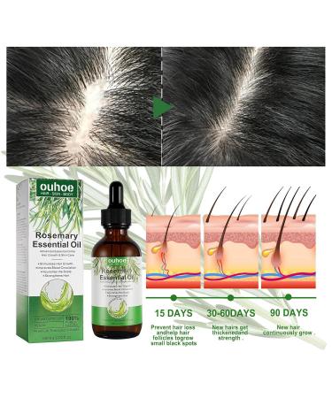 Organic Rosemary Oil for Hair Growth | Scalp & Hair Powering Aroma Therapy | Bexdug Pink Marine Oil with Glass Dripper - Improves Split Ends & Dry Scalp - Buy Online on SooperMarket.com