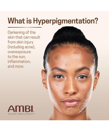 Ambi Even & Clear Fade Cream - Hyperpigmentation Treatment, Dark Spot Corrector with Niacinamide & Licorice Root Extract - 1 Fl Oz - Buy Online on SooperMarket.com