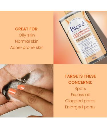 Bior Charcoal Acne Clearing Cleanser Salicylic Acid Facial Wash for Oily Acne Prone Skin (200 mL) - Packaging May Vary - Buy Online on SooperMarket.com