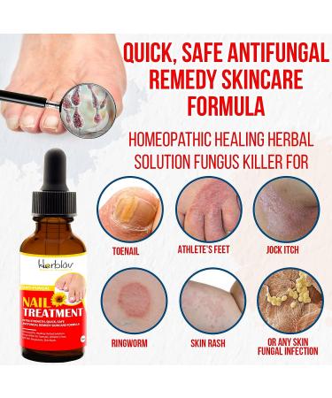 Natural Nail & Toenail Repair Treatment - Extra Strength Drops for Nails, Athlete's Feet, Jock Itch, Ringworm & Skin Rash - USA Made - Buy Online on SooperMarket.com