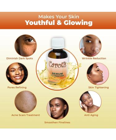 Carotis Brightening Serum 1oz - Fade Brown Spots with Alpha Arbutin & Beta Carotene - Buy Online on SooperMarket.com