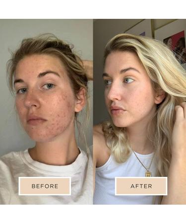 Averr Aglow Clarifying Hydration Dew - Natural Daily Face Moisturizer for Clear Skin - Buy Online on SooperMarket.com
