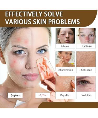 Ice Roller for Face and Eyes - Reusable Silicone Mold Face Ice Roller for Tightens and Shrinks Pores Relief Eye Puffiness Improve Skin Elasticity - Facial Beauty Skin Care Tools Birthday Gifts for Her - Buy Online on SooperMarket.com