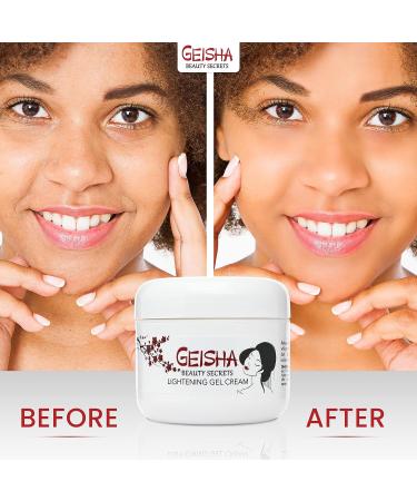 Geisha Kojic Acid Cream - 1.7 fl oz - Dark Spot Remover for Face, Body & Hands - Hyperpigmentation Treatment with Glycolic Acid - Buy Online on SooperMarket.com