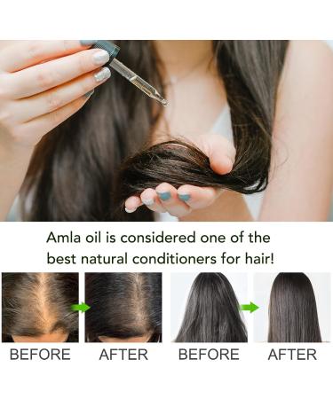 SBHEANGBA Cold Pressed Amla Oil - 100% Pure Organic Hair Growth Treatment Nourishing Scalp & Moisture 2.02 Fl Oz - Buy Online on SooperMarket.com