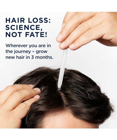 Head & Shoulders Scalp X Minoxidil for Men - Pack of 3 - 2 Fl Oz. - Buy Online on SooperMarket.com
