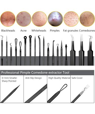 Blackhead Remover Pimple Popper Tool Kit - 19 Pcs Professional Extractor Set for Face and Nose - Stainless Steel Comedone and Whitehead Extractor with Metal Case (Black) - Buy Online on SooperMarket.com