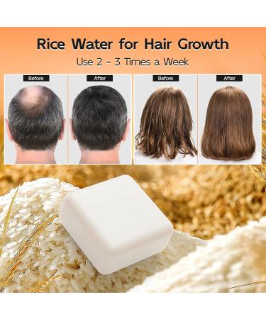 Fermented Rice Water Shampoo Bar for Hair Growth & Moisture | 3.4 Oz - Nourish Dry Damaged Hair & Reduce Hair Loss - Buy Online on SooperMarket.com