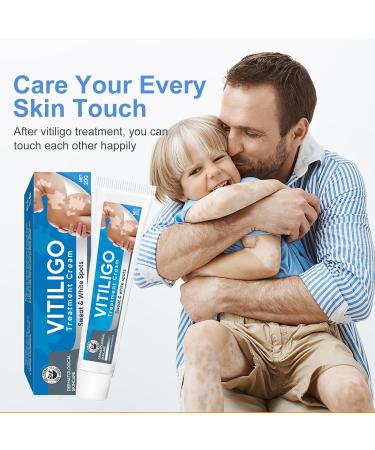 UpdateClassic Vitiligo Cream | Natural Vitiligo Treatment for Skin | Reduce White Spots & Improve Pigmentation | Easy to Use | Blue/Vitiligo - Buy Online on SooperMarket.com
