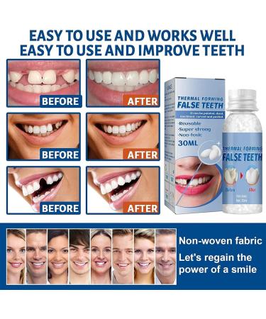 Shop WTTFC Provisional Dentures & Temporary Tooth Repair Kit - Degradable Adhesive Pearls for Missing Teeth - Fast International Shipping - Buy Online on SooperMarket.com