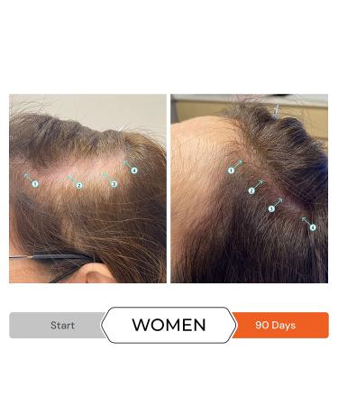 Revita Volumizing Conditioner for Thinning Hair - Hair Growth Support for Men and Women - Hair Thickening and Strengthening - Sulfate Free - 31 fl oz - Buy Online on SooperMarket.com