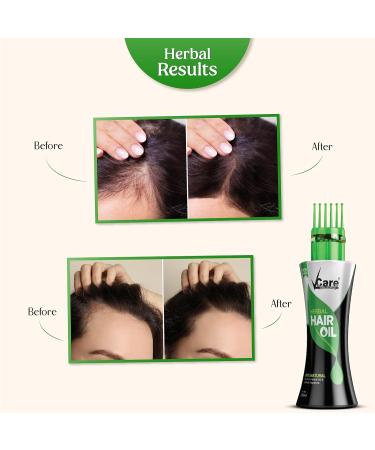 Buy New Improved Herbal Hair Oil with Wonder Cap (100 ml) - Enhance Hair Growth & Shine | International Shipping Available - Buy Online on SooperMarket.com