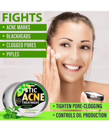 Cystic Acne Treatment & Scar Remover - USA Made Severe Acne Cleanser with Tea Tree Oil - Prevent Breakouts - Natural Pimple Cream - Buy Online on SooperMarket.com