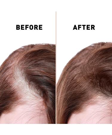 Bald Spot Hair Growth Cream | Scalp Treatment for Receding Hair | Just Nutritive | 4 Oz | Unisex Hair Restoration - Buy Online on SooperMarket.com