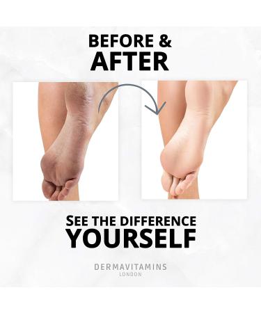 Dermavitamins Advanced Exfoliating Foot Mask Bag - Repair Dry Feet | Effective Foot Care Solution - Buy Online on SooperMarket.com